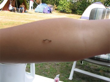 beestje op arm beestje op arm